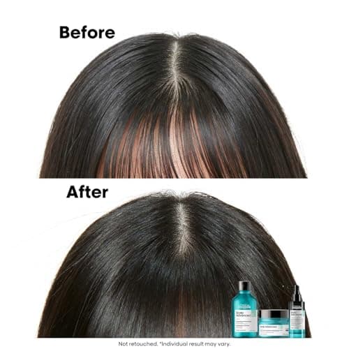 L’Oréal Professionnel Scalp Advanced Anti-Oiliness 2-In-1 Deep Purifier Clay 250gms| For Very Oily Scalps | Purifies the Scalp Deeply with 3% AHA & 6% Clay | For Men & Women