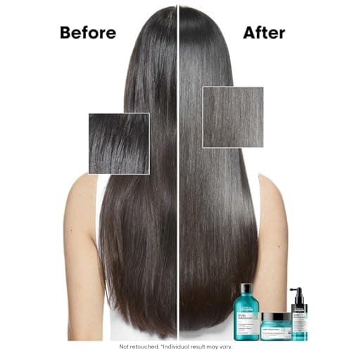 L’Oréal Professionnel Scalp Advanced Anti-Oiliness 2-In-1 Deep Purifier Clay 250gms| For Very Oily Scalps | Purifies the Scalp Deeply with 3% AHA & 6% Clay | For Men & Women