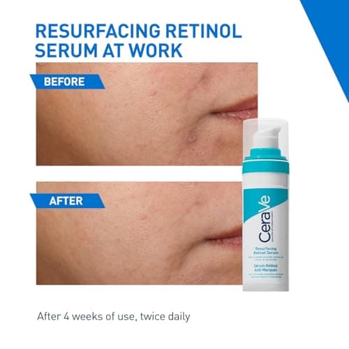 CeraVe Resurfacing Retinol Serum For Blemish-Prone Skin, Reduces Post Acne Marks & Pores, Formulated with Licorice Root Extract & Niacinamide, Non-Comedogenic, 30ml