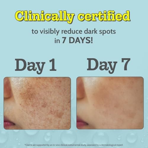 Chemist At Play 10% Vitamin C Face Serum for Brightening & Glow | Fades Dark Spots & Hyperpigmentation | With Ethyl Ascorbic Acid & Glucosamine | All Skin Types | For Men & Women | 10 ml