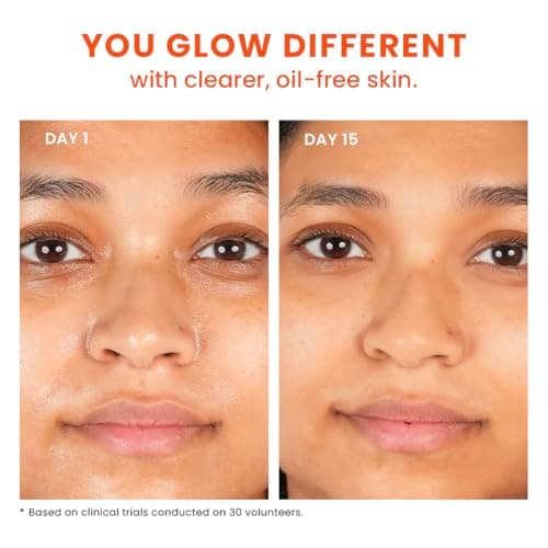 Foxtale Oil-Balancing Gel Moisturizer with Niacinamide, Azelaic Acid Pearls & Cica, 8hr Shine-Free Hydration, Lightweight, Sebum Control, For Oily & Acne-Prone Skin, 50 ml | For Men & Women