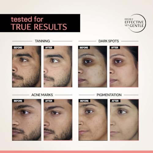 Deconstruct 5% Niacinamide Serum + 2% Alpha Arbutin Clearing Serum| Clinically Tested| Reduces Dark Spots, Pigmentation, Acne Marks & Tanning |4-in-1 Multi-Benefit |Non-Irritating |30ml