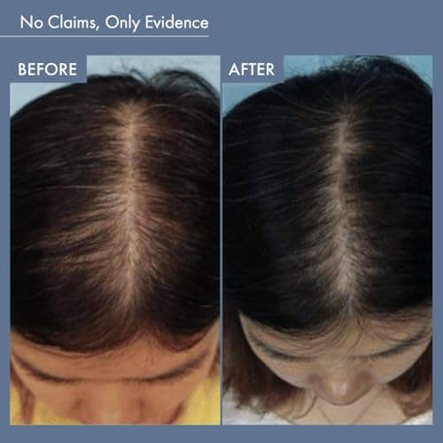 ThriveCo Rosemary Shampoo for Hair Fall Control & Advanced Hair Growth | Promotes Strong Hair Roots & Healthy Scalp | With Rosemary, Rice Water Pea Peptide, Caffeine,& Hyaplex | Men & Women | 250ml