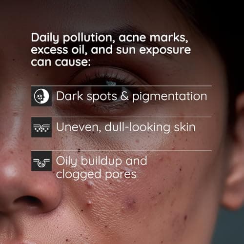 Turmeric & Kojic Acid Face Cleansing Pads for Dark Spots, Skin Brightening & Acne Removal | For Women & Men | All Skin Type | 50 Pads