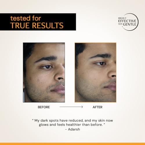 Deconstruct 10% Vitamin C Serum for Glowing Skin| Clinically Tested to be Non-Irritating| Beginner-Friendly| Brightens Dull Skin, Evens Tone| For Oily Skin| With Ferulic Acid| For Men and Women| 30ml