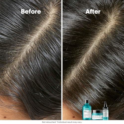 L’Oréal Professionnel Scalp Advanced Anti-Oiliness 2-In-1 Deep Purifier Clay 250gms| For Very Oily Scalps | Purifies the Scalp Deeply with 3% AHA & 6% Clay | For Men & Women