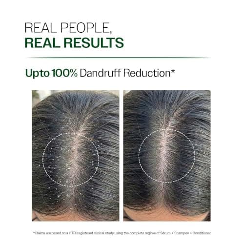 Bare Anatomy Anti-Dandruff Shampoo | Up To 100% Dandruff Reduction | ZPTO-Free | pH 5.3 | Salicylic Acid, Piroctone Olamine & Biotin | Non-Drying Formula | For Strong, Smooth Hair | Unisex | 100 ml