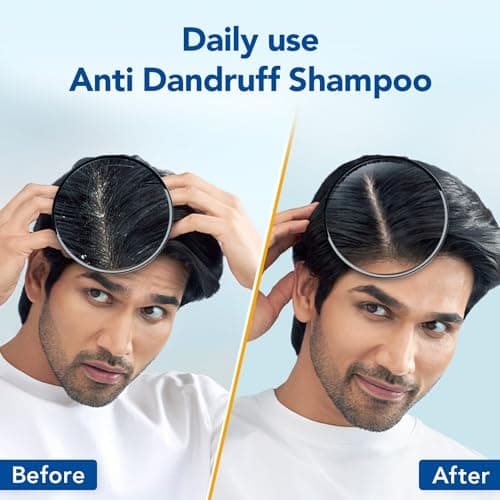 Scalpe Pro Daily Anti-Dandruff Shampoo | Removes Dandruff from Source | Prevents Itching & Irritation | Scalpe Science | Climbazole Formulation | Dermatologically Tested | For Women & Men | 200ml