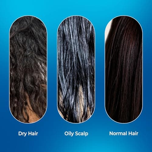 VINR Rosemary Water Spray for Hair Growth & Thickness | Infused With Vitis Vinifera | Enriched with Rice Water & Grape Extract | 100% Natural Rosemary Hair Mist | Controls Hairfall, Adds Shine & Softness | Fast-Absorbing (100 ml)