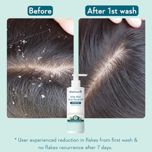 WishCare Hydrating Anti Dandruff Shampoo | 100% Dandruff Reduction | Removes Flakes & Hydrates Scalp | Proven Clinically | Piroctone Olamine, Salicylic Acid, AHA & BHA | Paraben & Sulphate Free | For Women And Men | 250ml