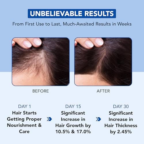 Botanic Hearth 100% Pure Rosemary Oil For Hair Growth Infused With Biotin | Hair Strenghtening Treatment | Nourishing & Volumizing | With Jojoba Oil & Castor Oil | Non GMO Verified | 198 ML