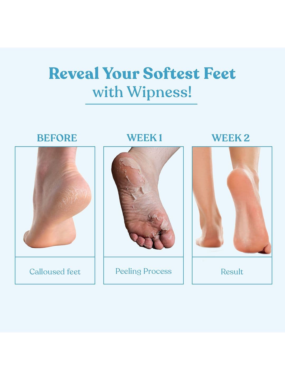 Wipness Natural Foot Exfoliating Peeling Mask - 2 Pairs
