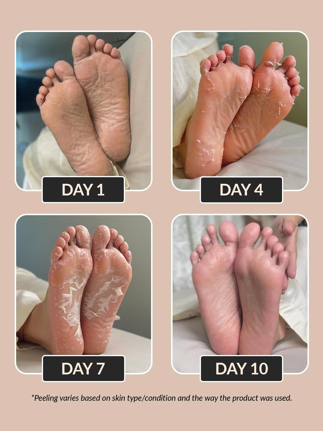 LuxaDerme Set Of 2 Peeling & Exfoliating Foot Mask - 40ml Each