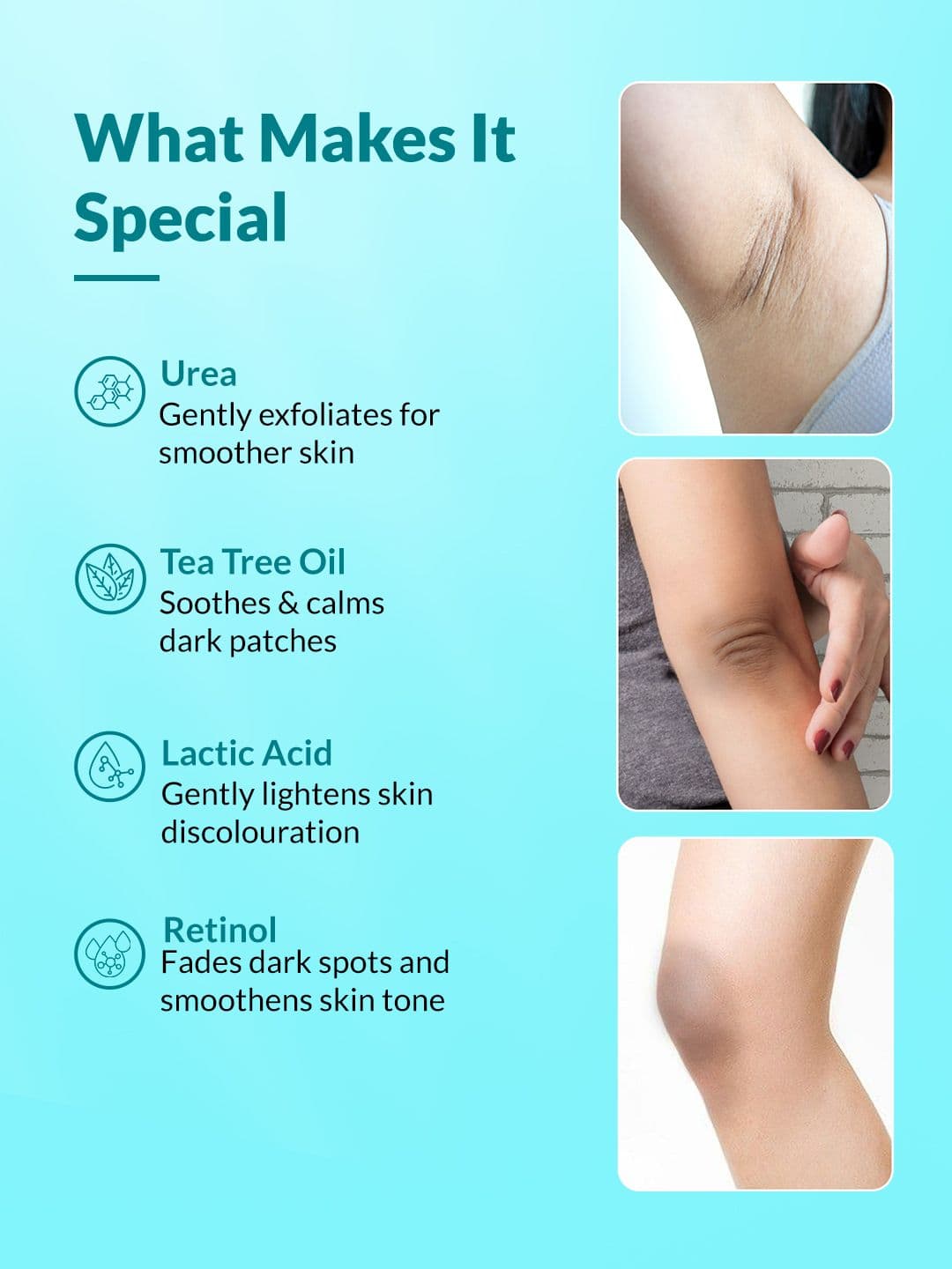 FIXDERMA Nigrifix Cream for Acanthosis Nigricans For Dark Neck & Ankles - 50g