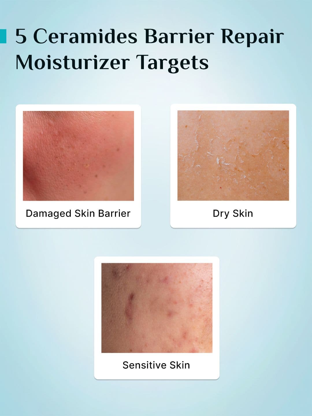 Pilgrim 5 Ceramides Barrier Repair Lightweight Moisturizer with Koeran CICA - 100 g