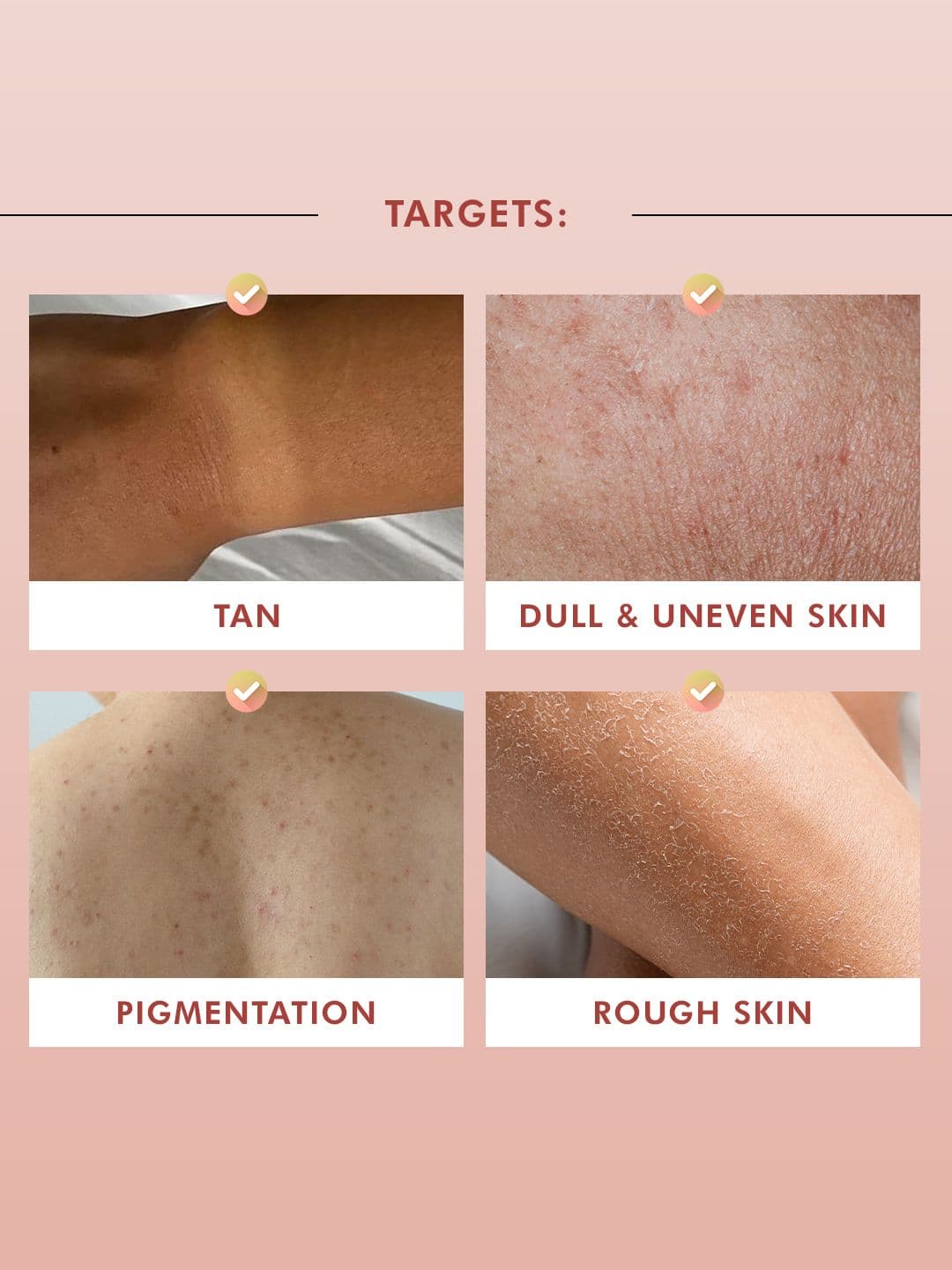 MCaffeine Detan Body Wash with 1% Glycolic 5% Niacinamide-Kojic Acid for Dark Spots -300ml